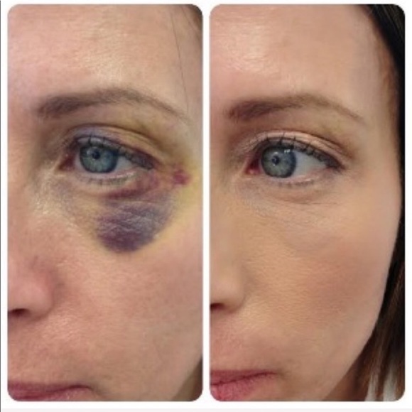 Corrective Colors Jane Iredale - Picture 3 of 8